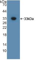 Polyclonal Antibody to Glypican 3 (GPC3)