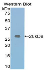 Polyclonal Antibody to Retinoic Acid Receptor Alpha (RARa)