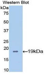 Polyclonal Antibody to Cyclophilin A (CYPA)