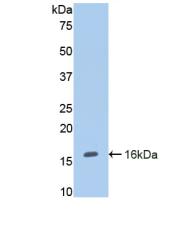 Polyclonal Antibody to Endoglin (ENG)