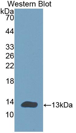 Polyclonal Antibody to Cholinergic Receptor, Nicotinic, Alpha 1 (CHRNa1)