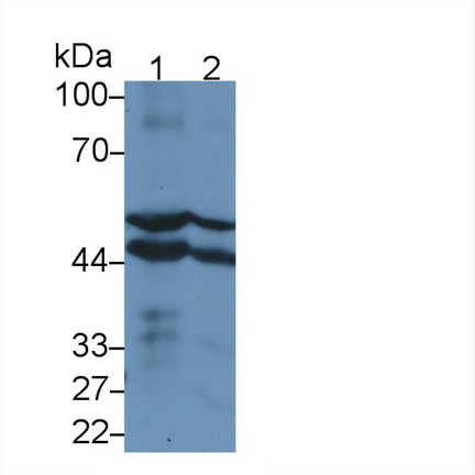 Polyclonal Antibody to Cytochrome P450 2E1 (CYP2E1)