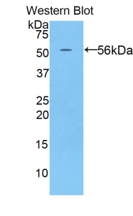 Polyclonal Antibody to Placental Cadherin (P-cadherin)