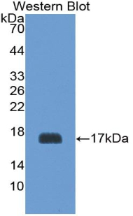 Polyclonal Antibody to Platelet Glycoprotein Ib Beta Chain (GP1BB)