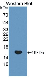 Polyclonal Antibody to Platelet Glycoprotein Ib Beta Chain (GP1BB)