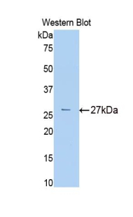 Polyclonal Antibody to Alpha-2-Macroglobulin (a2M)