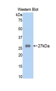 Polyclonal Antibody to Alpha-2-Macroglobulin (a2M)