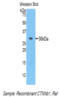 Polyclonal Antibody to Beta Catenin (β-catenin)