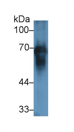 Polyclonal Antibody to Albumin (ALB)