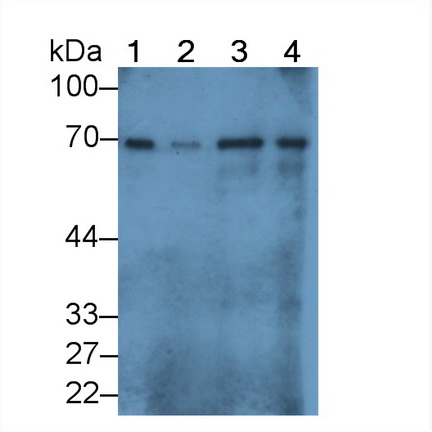 Polyclonal Antibody to Albumin (ALB)