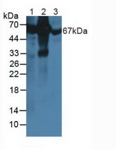 Polyclonal Antibody to Albumin (ALB)