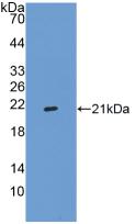Polyclonal Antibody to Integrin Alpha 2B (ITGa2B)