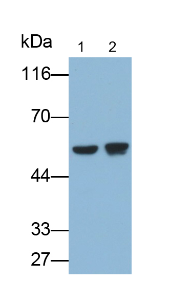 Polyclonal Antibody to Vimentin (VIM)