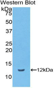 Polyclonal Antibody to Vitronectin (VTN)