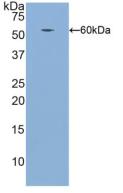 Polyclonal Antibody to Integrin Beta 1 (ITGb1)