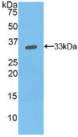 Polyclonal Antibody to Integrin Beta 1 (ITGb1)