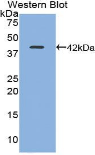 Polyclonal Antibody to Trefoil Factor 1 (TFF1)