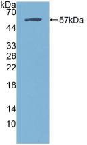 Polyclonal Antibody to Estrogen Receptor Alpha (ERa)