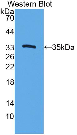 Polyclonal Antibody to Cytochrome P450 7A1 (CYP7A1)