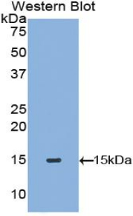 Polyclonal Antibody to Tryptase (TPS)