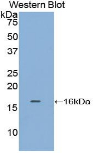 Polyclonal Antibody to Tryptase (TPS)