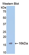 Polyclonal Antibody to Tryptase (TPS)