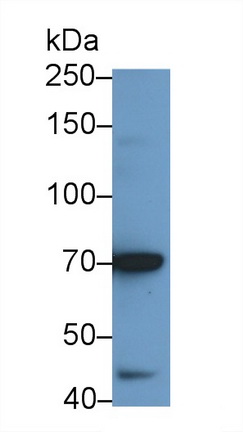 Polyclonal Antibody to Interleukin 12 Receptor Beta 2 (IL12Rb2)