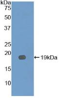 Polyclonal Antibody to Interleukin 12 Receptor Beta 2 (IL12Rb2)