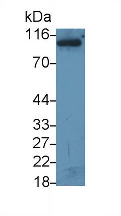 Polyclonal Antibody to Interleukin 12 Receptor Beta 2 (IL12Rb2)