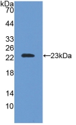 Polyclonal Antibody to Superoxide Dismutase 2, Mitochondrial (SOD2)