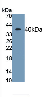 Polyclonal Antibody to Alkaline Phosphatase, Intestinal (ALPI)