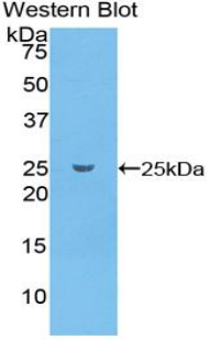 Polyclonal Antibody to Glutathione S Transferase Pi (GSTp)