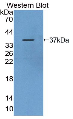 Polyclonal Antibody to Alkaline Phosphatase, Tissue-nonspecific (ALPL)