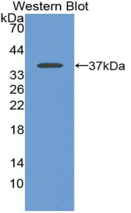 FITC-Linked Polyclonal Antibody to Alkaline Phosphatase, Tissue-nonspecific (ALPL)