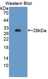 Polyclonal Antibody to Brain Finger Protein (BFP)