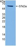 Polyclonal Antibody to Cluster Of Differentiation 8a (CD8a)