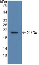 Polyclonal Antibody to Myosin Light Chain 2 (MYL2)