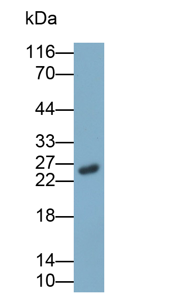 PAB105Hu01.jpg