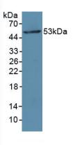 Polyclonal Antibody to Myosin Light Chain Kinase (MYLK)