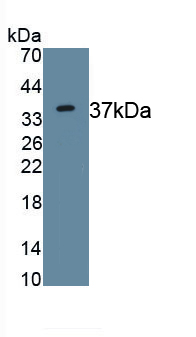 Polyclonal Antibody to Arginase (ARG)