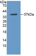 Polyclonal Antibody to Arginase (ARG)