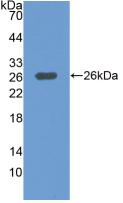 Polyclonal Antibody to Mitogen Activated Protein Kinase Kinase Kinase 1 (MAP3K1)