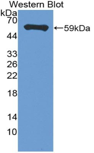 Polyclonal Antibody to Membrane Spanning 4 Domains Subfamily A, Member 1 (CD20)