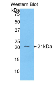 Polyclonal Antibody to Fibrinogen Alpha Chain (FGA)