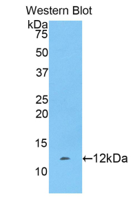 Polyclonal Antibody to Fibrinogen Alpha Chain (FGA)