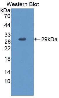 Polyclonal Antibody to Signaling Lymphocytic Activation Molecule Family, Member 5 (SLAMF5)