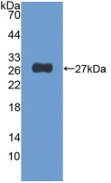 Polyclonal Antibody to Nucleoporin 155 (NUP155)