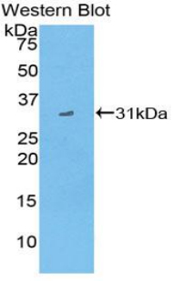 Polyclonal Antibody to Cluster Of Differentiation 1d (CD1d)