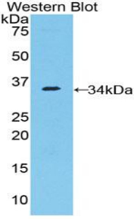 Polyclonal Antibody to Nucleoporin 205kDa (NUP205)