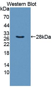 Polyclonal Antibody to Taxilin Alpha (TXLNa)